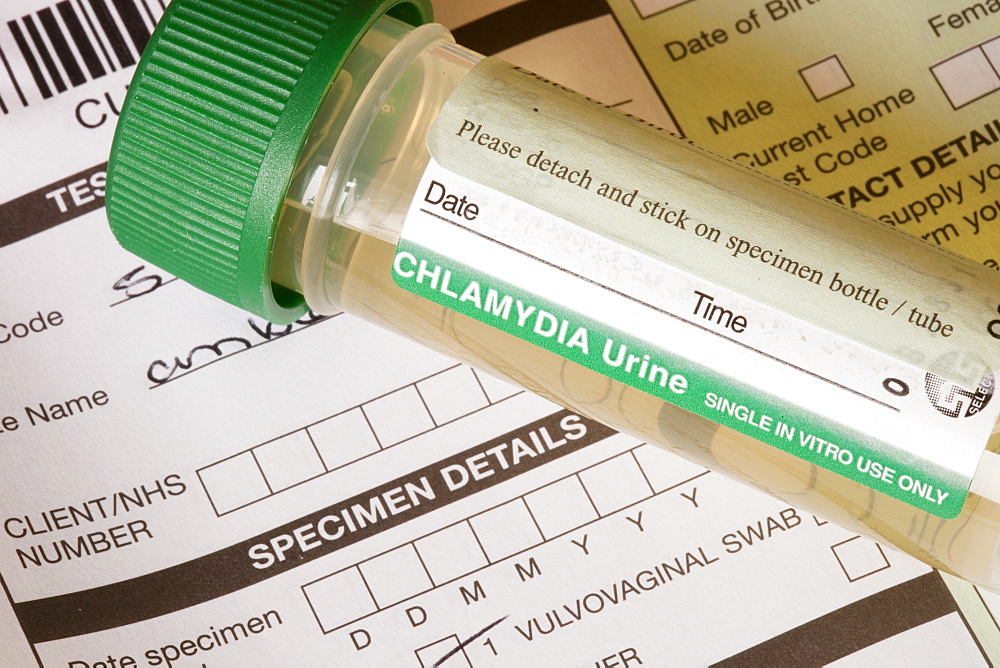 A Chlamydia self testing kit, United Kingdom, Europe