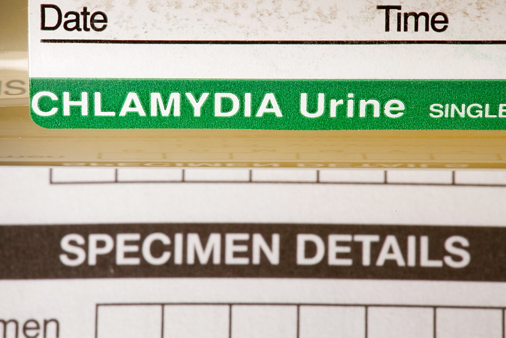 A Chlamydia self testing kit, United Kingdom, Europe