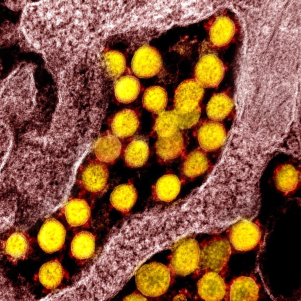 Novel coronavirus sars-cov-2