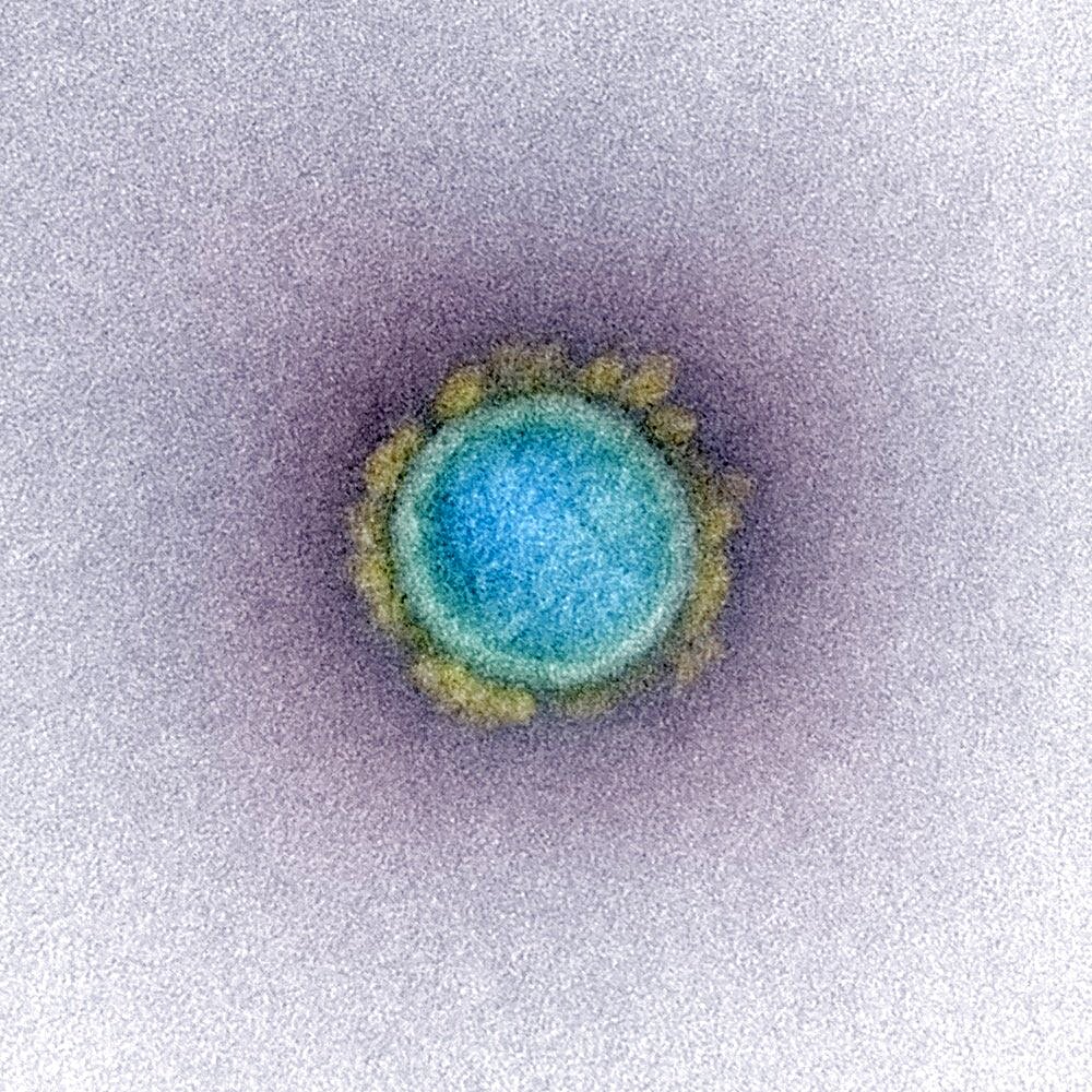 Novel coronavirus sars-cov-2