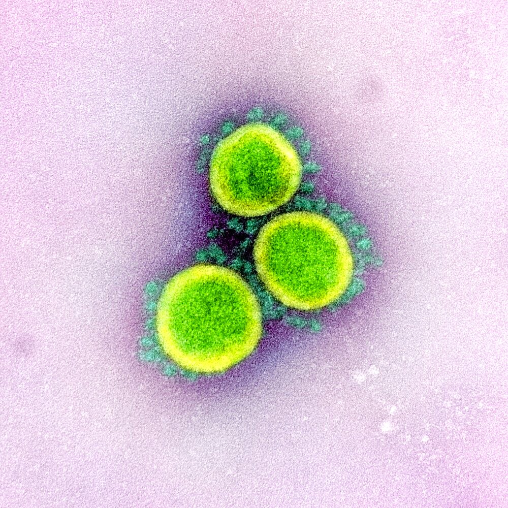 Novel coronavirus sars-cov-2