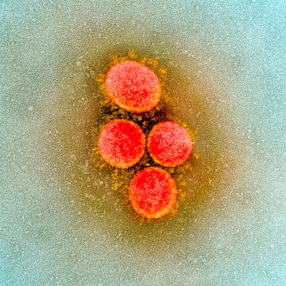 Novel coronavirus sars-cov-2