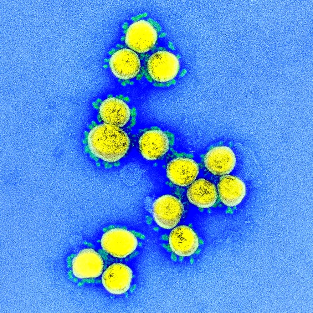 Novel coronavirus sars-cov-2