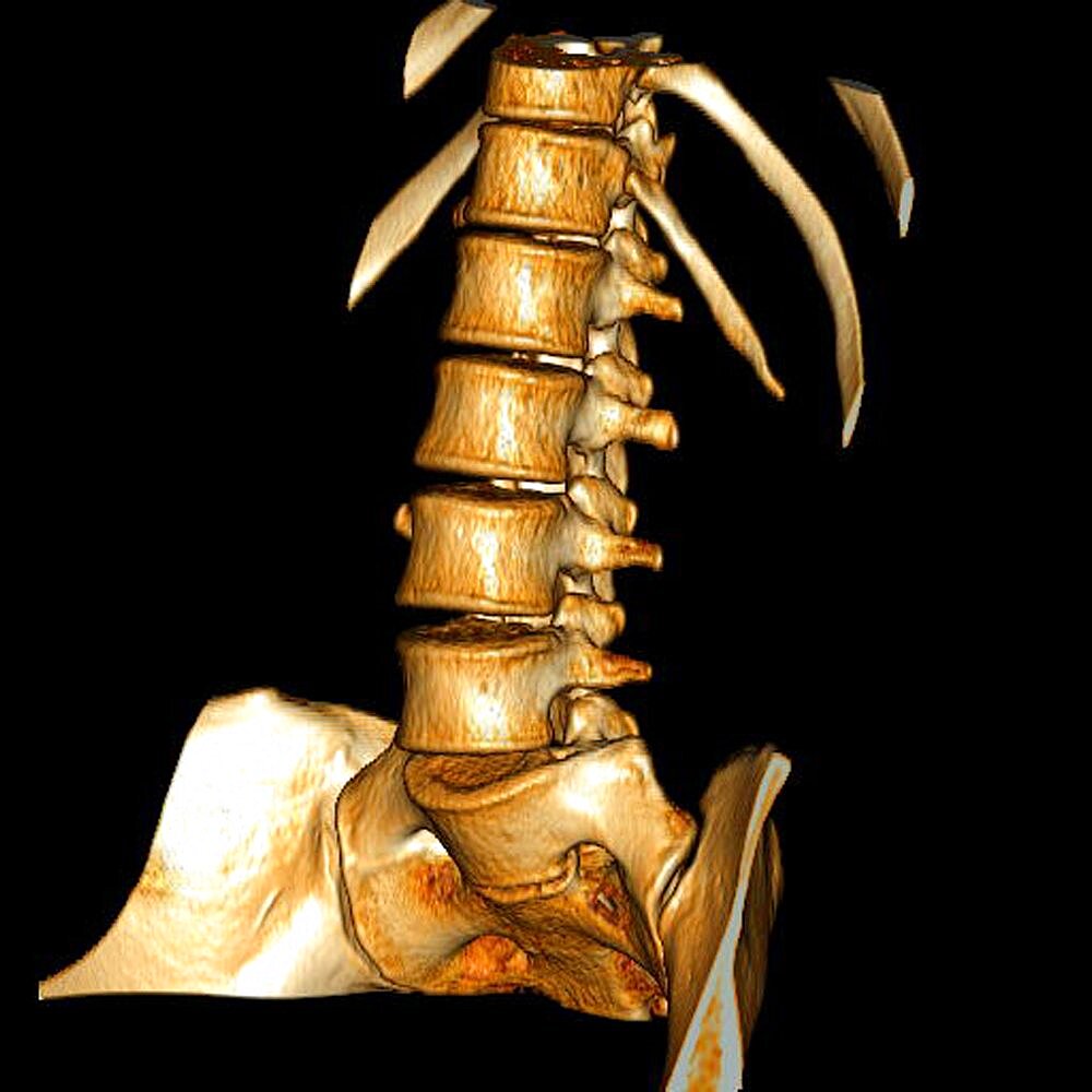 Lumbar, 3D Scan