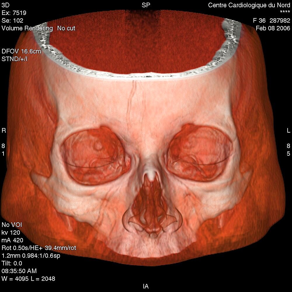 Head, 3D Scan