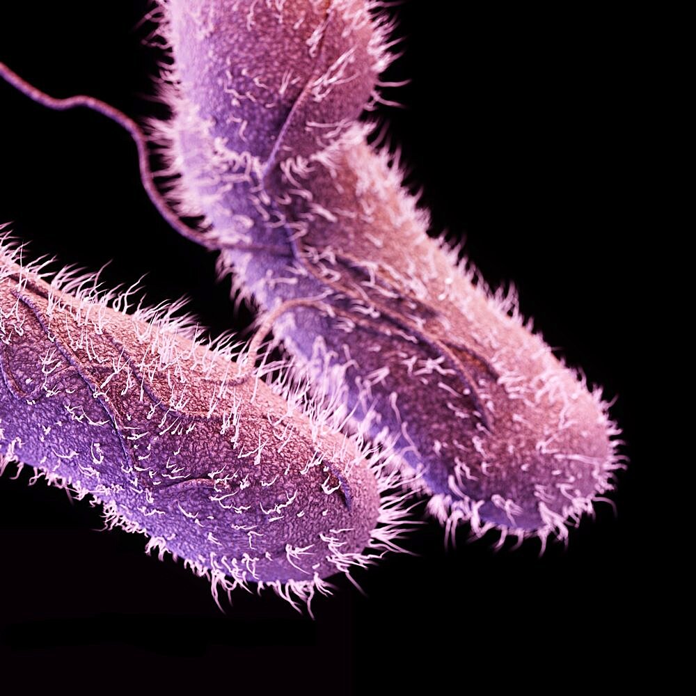 Drug-Resistant Non-Typhoidal Salmonella