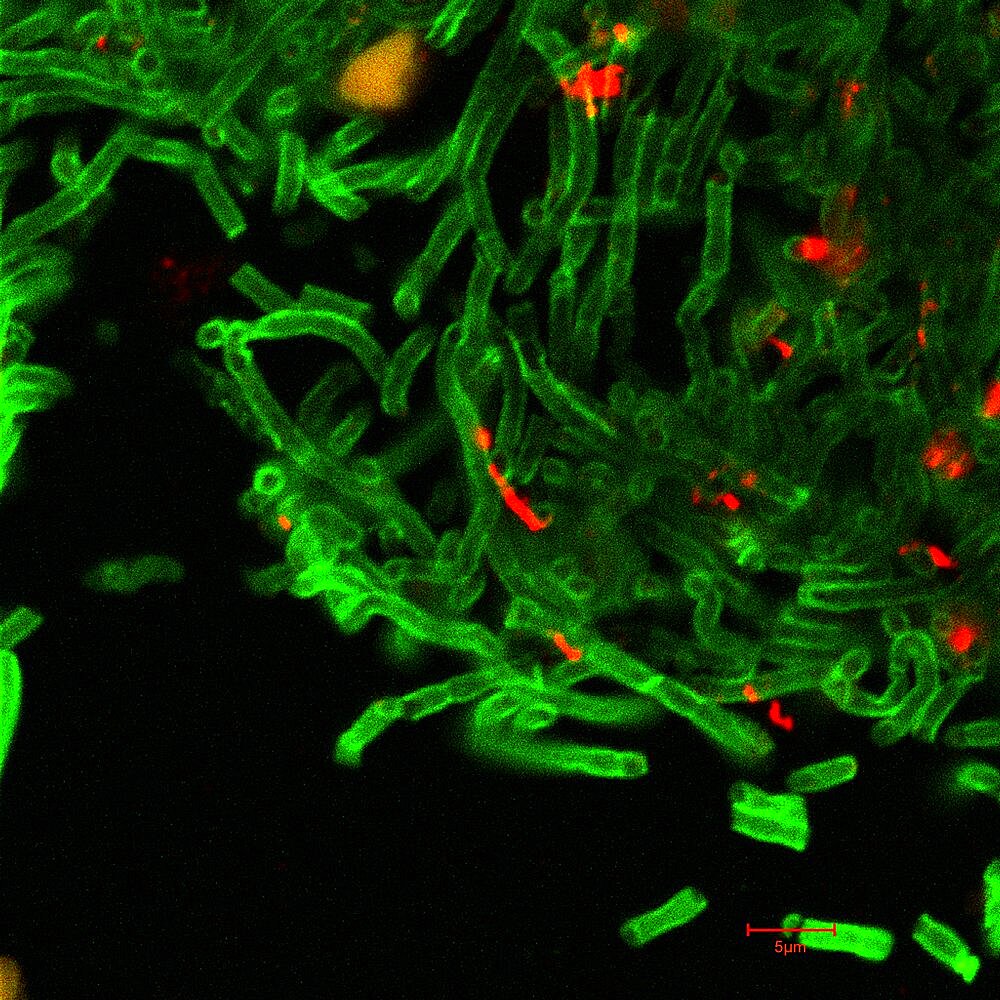 Anthrax, Bacillus anthracis Bacteria, CM