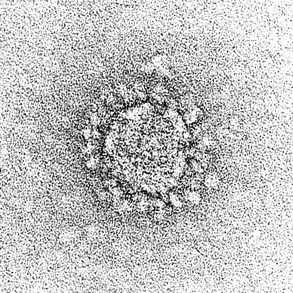 SARS-CoV-2, COVID-19 Virus, TEM