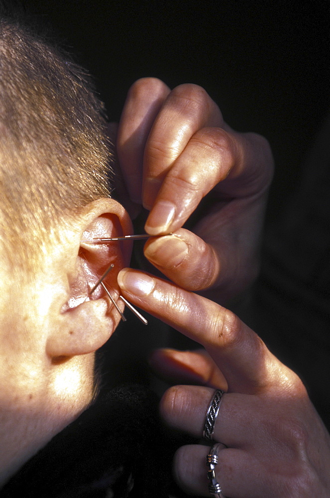 Healthcare, uk. South london. The charity mainliners offers acupuncture therapy to ex-drug addicts at a centre