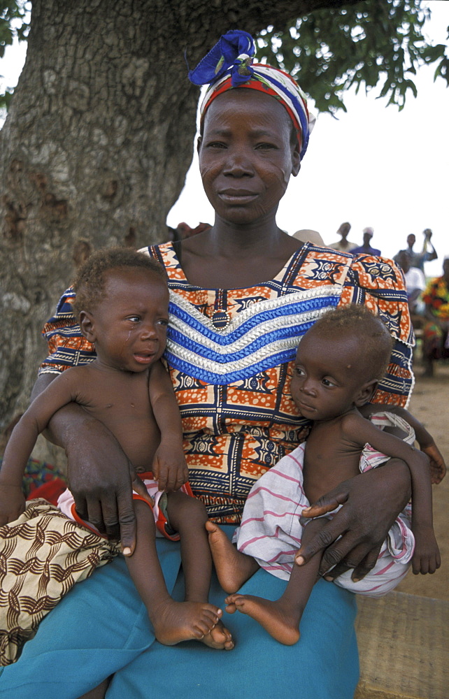 Ghana mother malnourished children bongo, bolgatanga