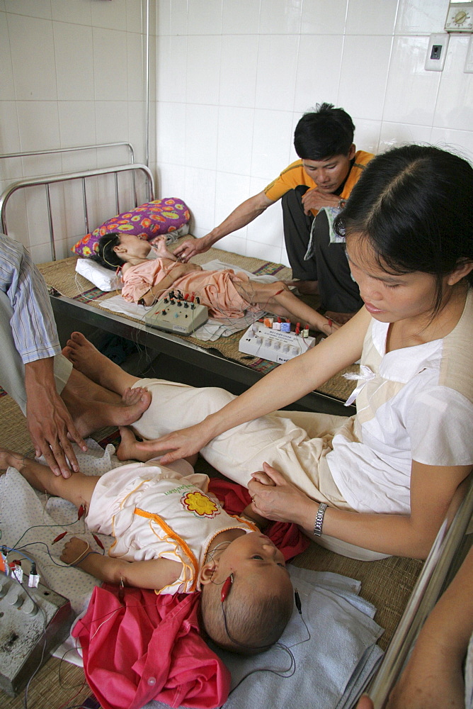 Vietnam child receiving acupuncture treatment at hospital in hanoi