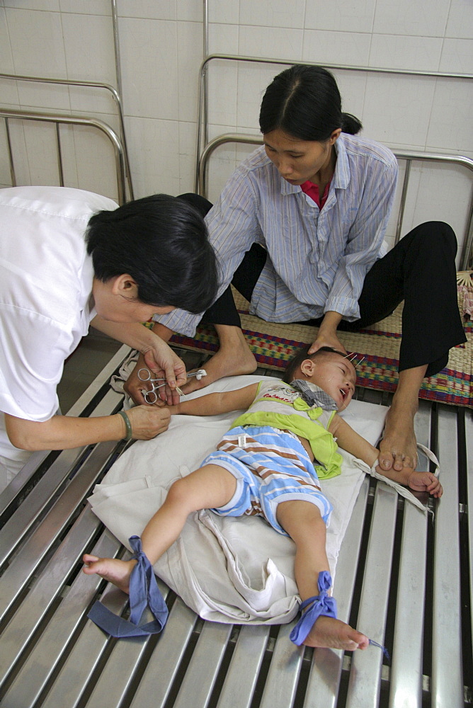 Vietnam child receiving acupuncture treatment at hospital in hanoi