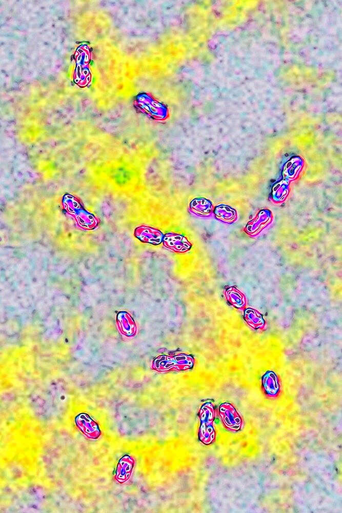 Pneumococcal bacteria