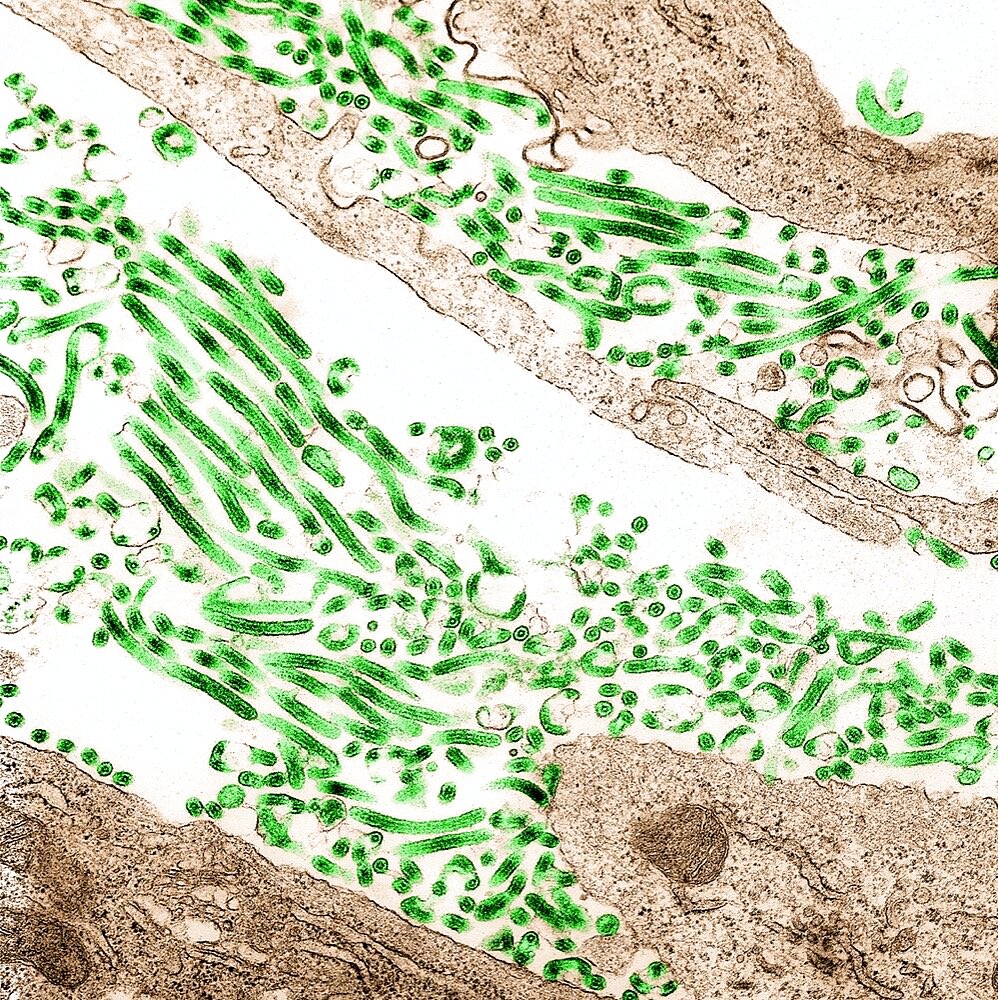 Ebola virus particles