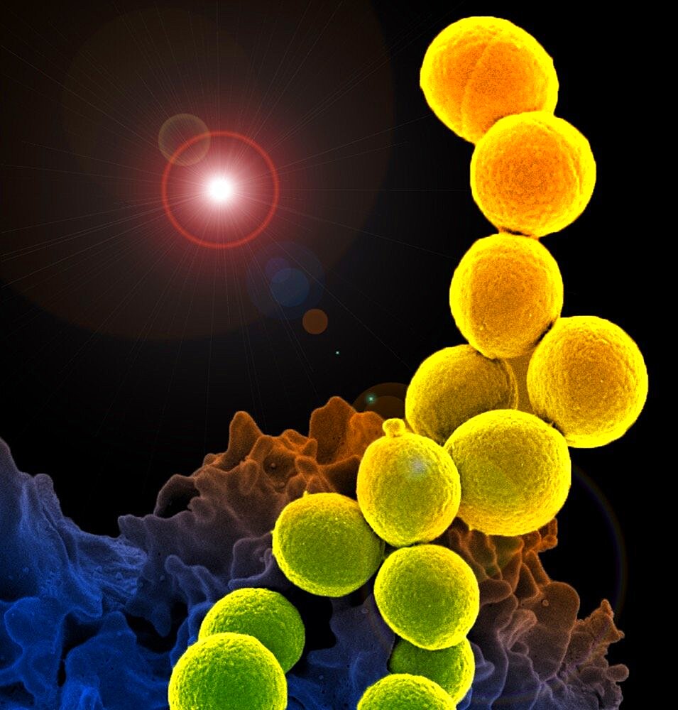 Methicillin-resistant staphylococcus aureus (mrsa)