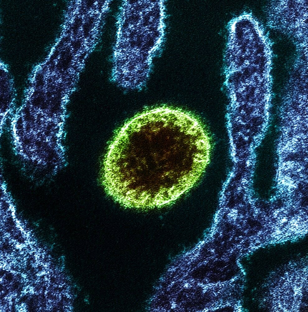 Nipah virus particle