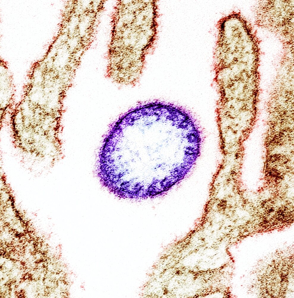 Nipah virus particle