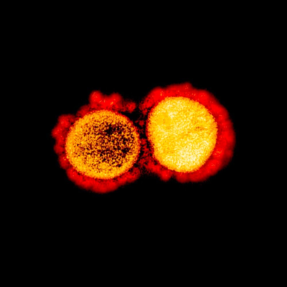 Novel coronavirus sars-cov-2