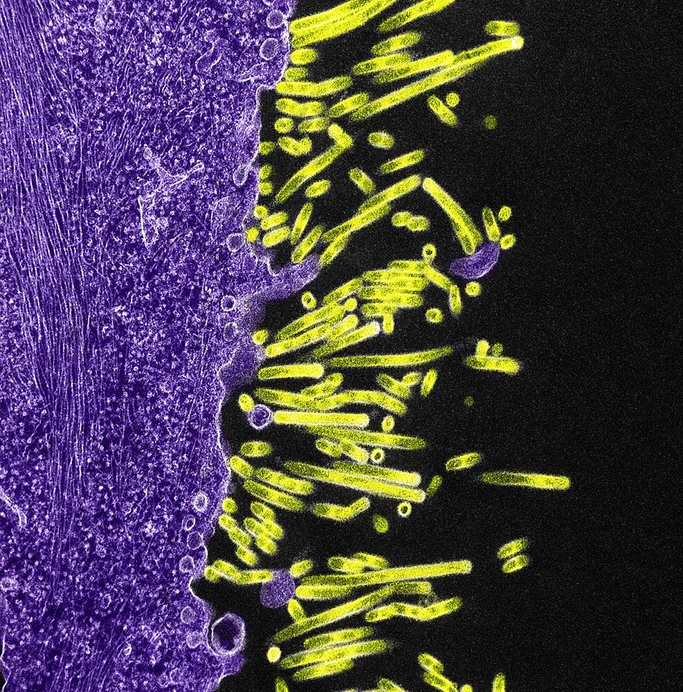 Swine flu virus particles