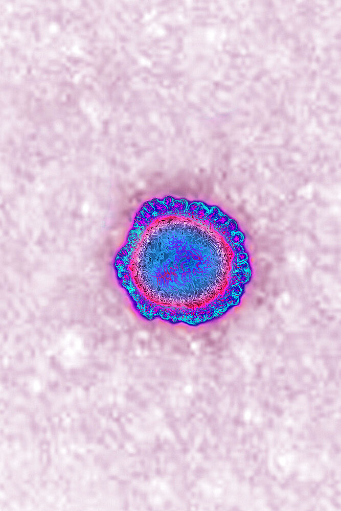 Coronavirus, virus of the family Coronaviridae and of the subfamily Orthocoronavirinae. View from a transmission electron microscopy (TEM) image