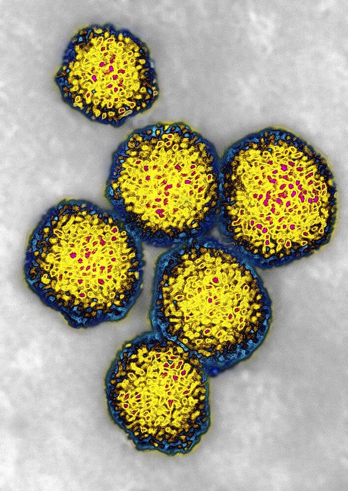 Hepatitis C Virus