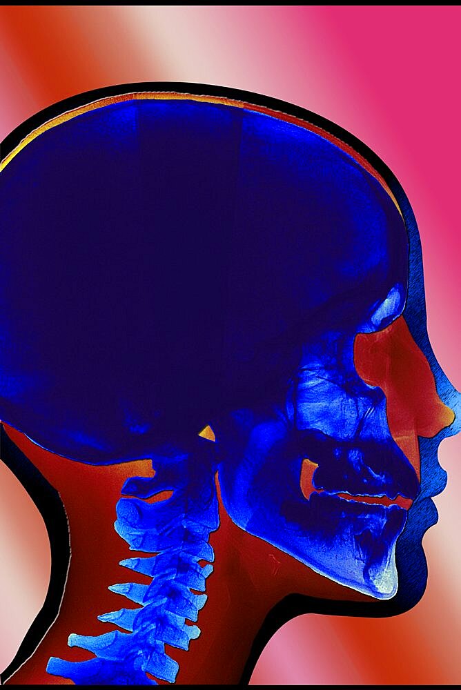 X Ray Of Head