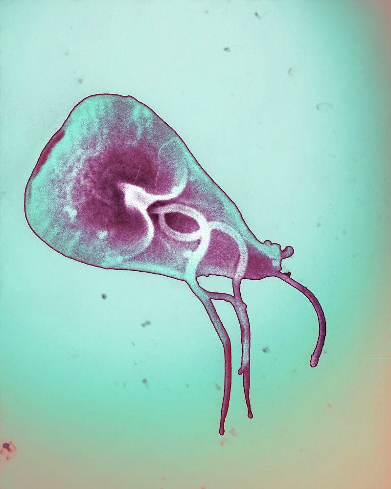 Giardia Lamblia