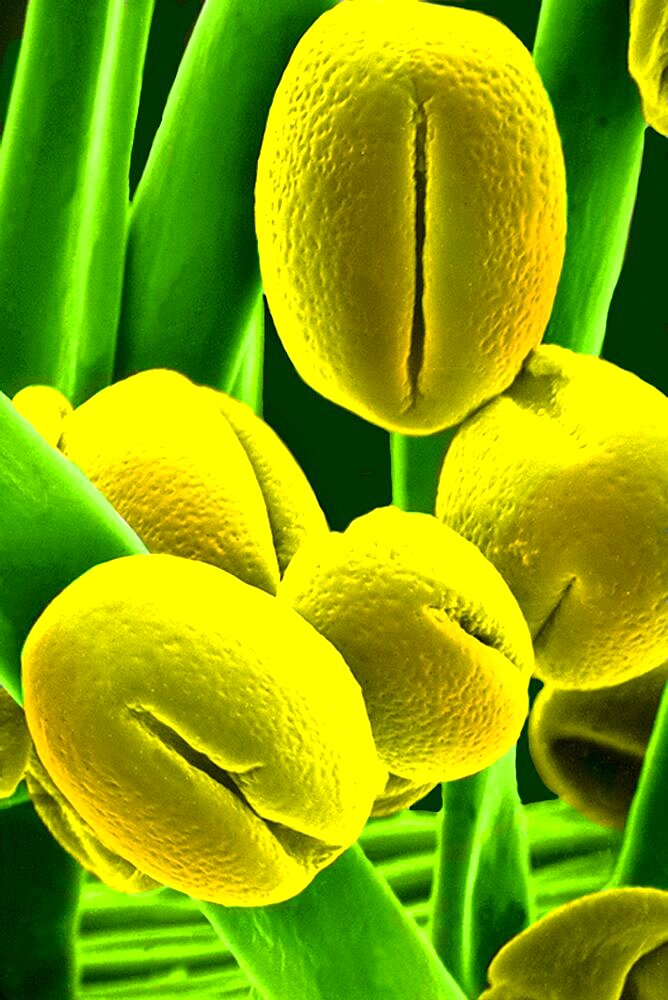 SEM image of Locust Tree pollen