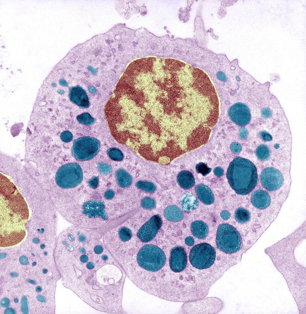 Eosinophil Granulocyte