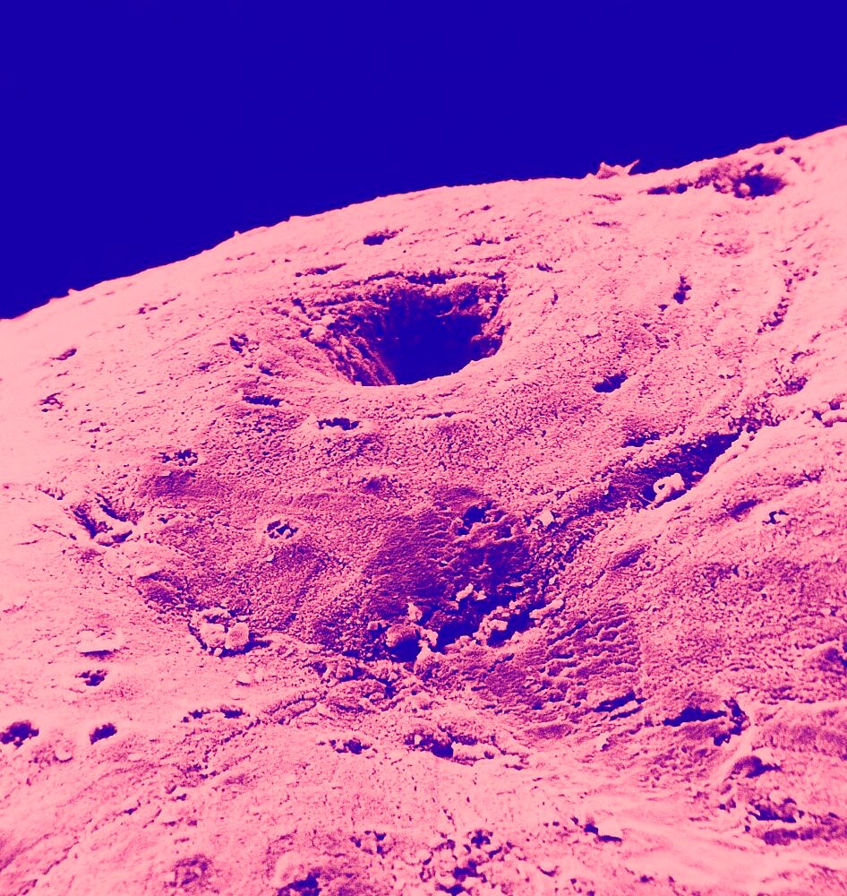 Mucosa Of The Colon, SEM