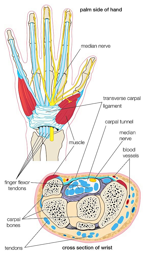 Carpal tunnel syndrome