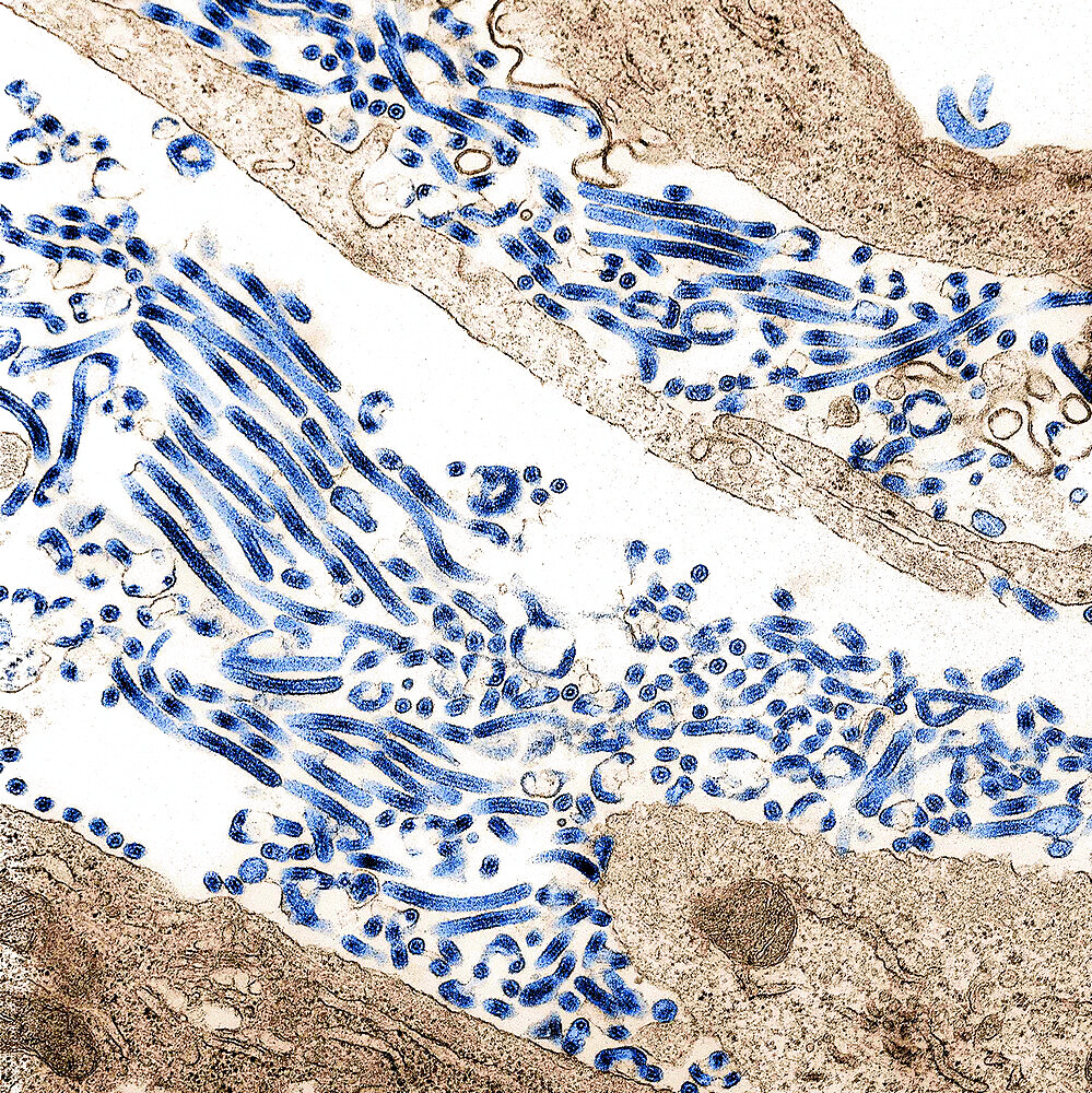 Ebola virus particles (blue) found both as extracellular particles and budding particles from chronically infected African green monkey kidney cells. Image captured and color-enhanced at the NIAID Integrated Research Facility in Ft. Detrick, Maryland.