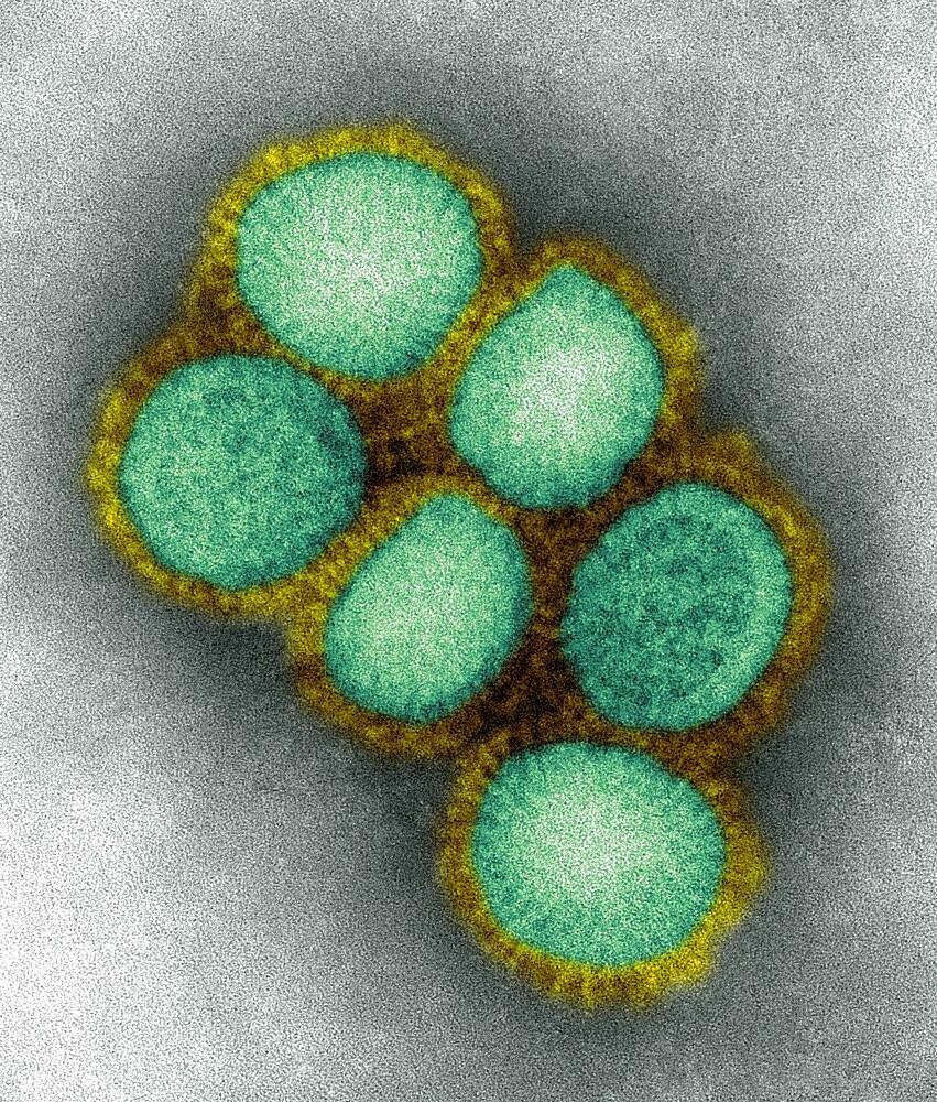 CA/4/09, Swine Flu Virus, TEM