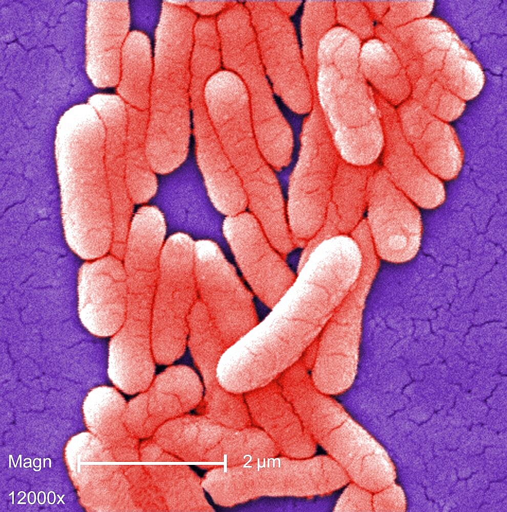 Salmonella typhimurium Bacteria, SEM