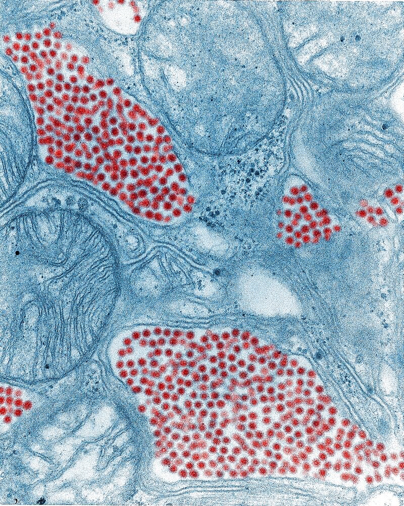 Eastern Equine Encephalitis Virus, TEM