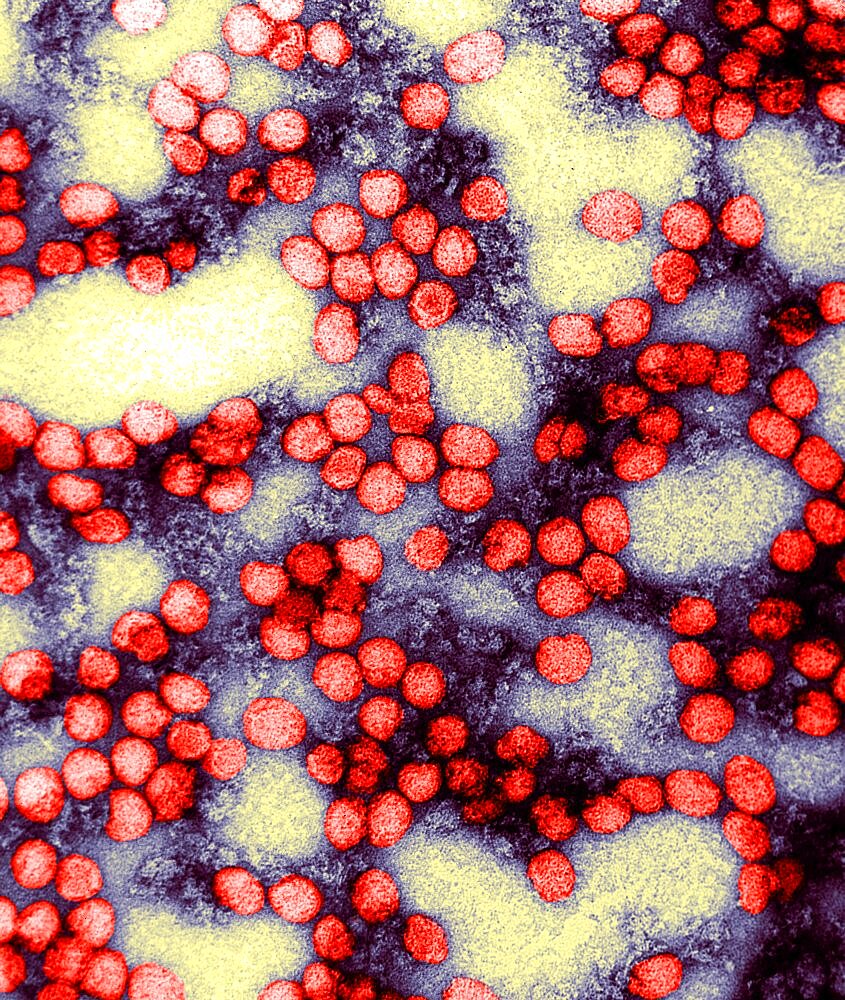 Flavivirus, Yellow Fever Virus, TEM