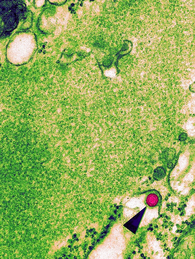 Rabies Virus, TEM