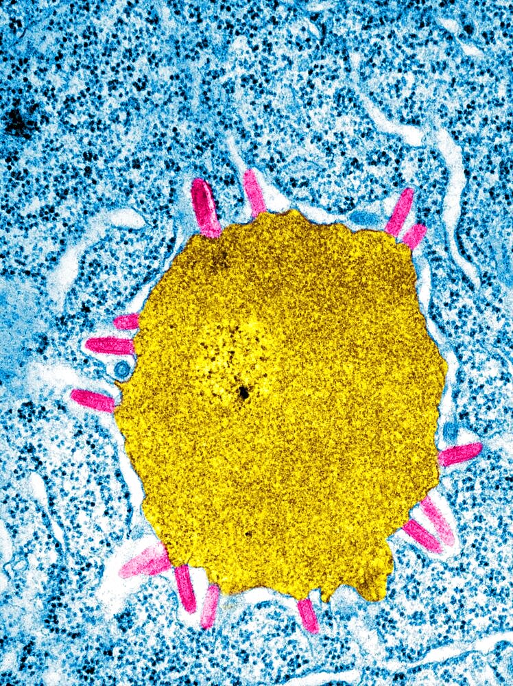 Lagos Bat Virus, TEM