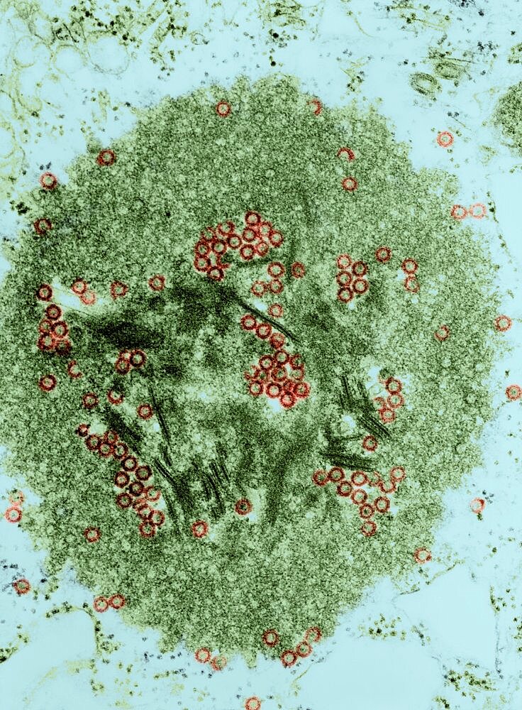 Tribec Virus, TEM