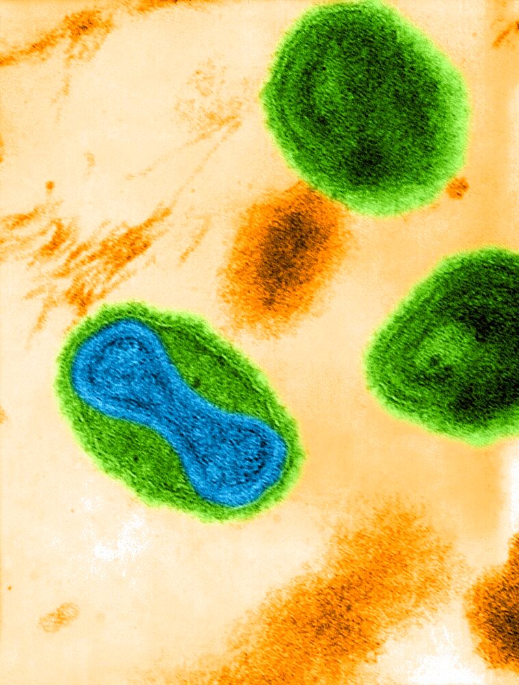 Smallpox Virus, TEM