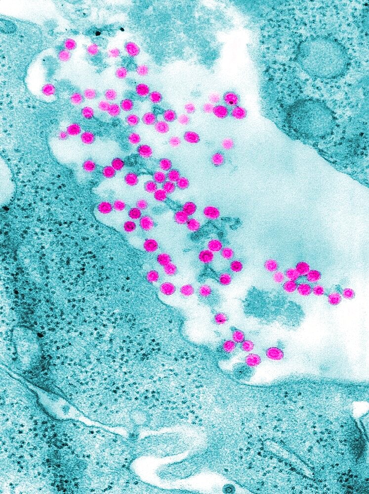 Rubella Virus, German Measles, TEM