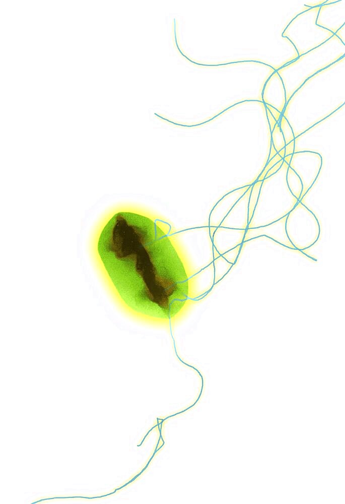 Escherichia coli O157:H7 Bacteria, TEM