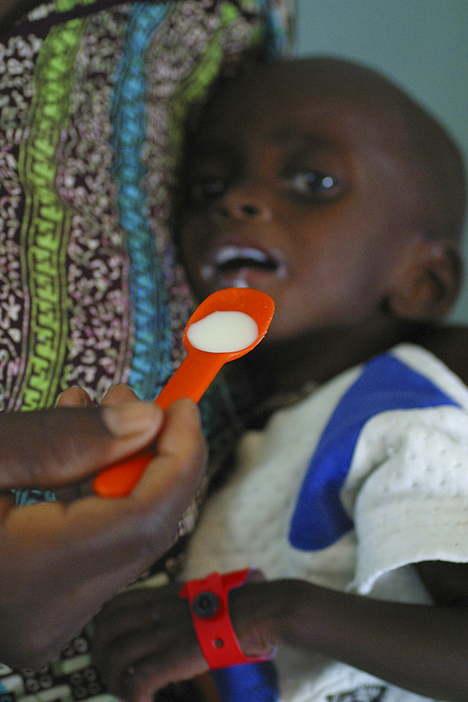 malnourished child in a clinic during the famine in 2008, nigeria