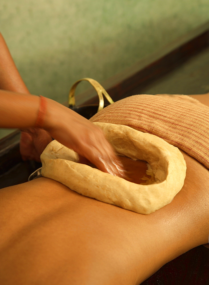 Kathi Vasti Treatment, an Ayurvedic procedure retaining warm medicated oil over the lower back within a border of herbal paste