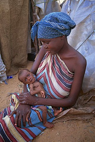 Refugee and her emaciated baby in a camp in Mogadishu in 1992, Somalia, Africa