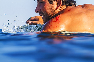 Photograph of surfer in sea with blood on shoulder, Lakey Peak, central Sumbawa, Indonesia