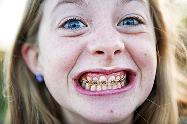 Teenage girl shows off her braces, Lincoln, Nebraska, United States of America