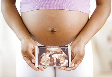 Pregnant African American woman holding ultrasound printout