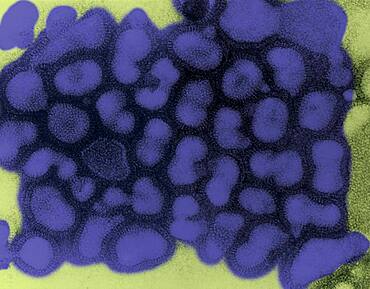 Transmission electron micrograph of influenza A virus, late passage.