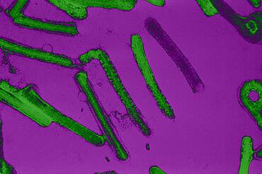 This electron micrograph depicts a number of Marburg virions responsible for causing Marburg Hemorrhagic Fever.